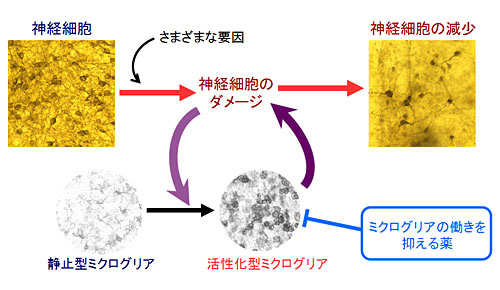 図２　活性化型ミクログリアは神経細胞にダメージを与える